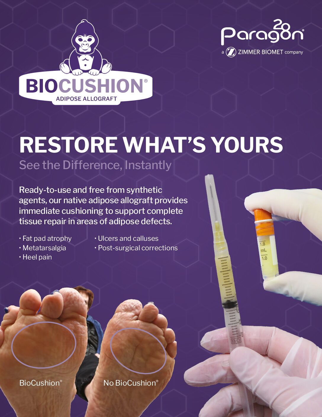 https://paragon28.com/app/uploads/2020/01/C33436-BioCushion-Brochure-v02-pdf.jpg