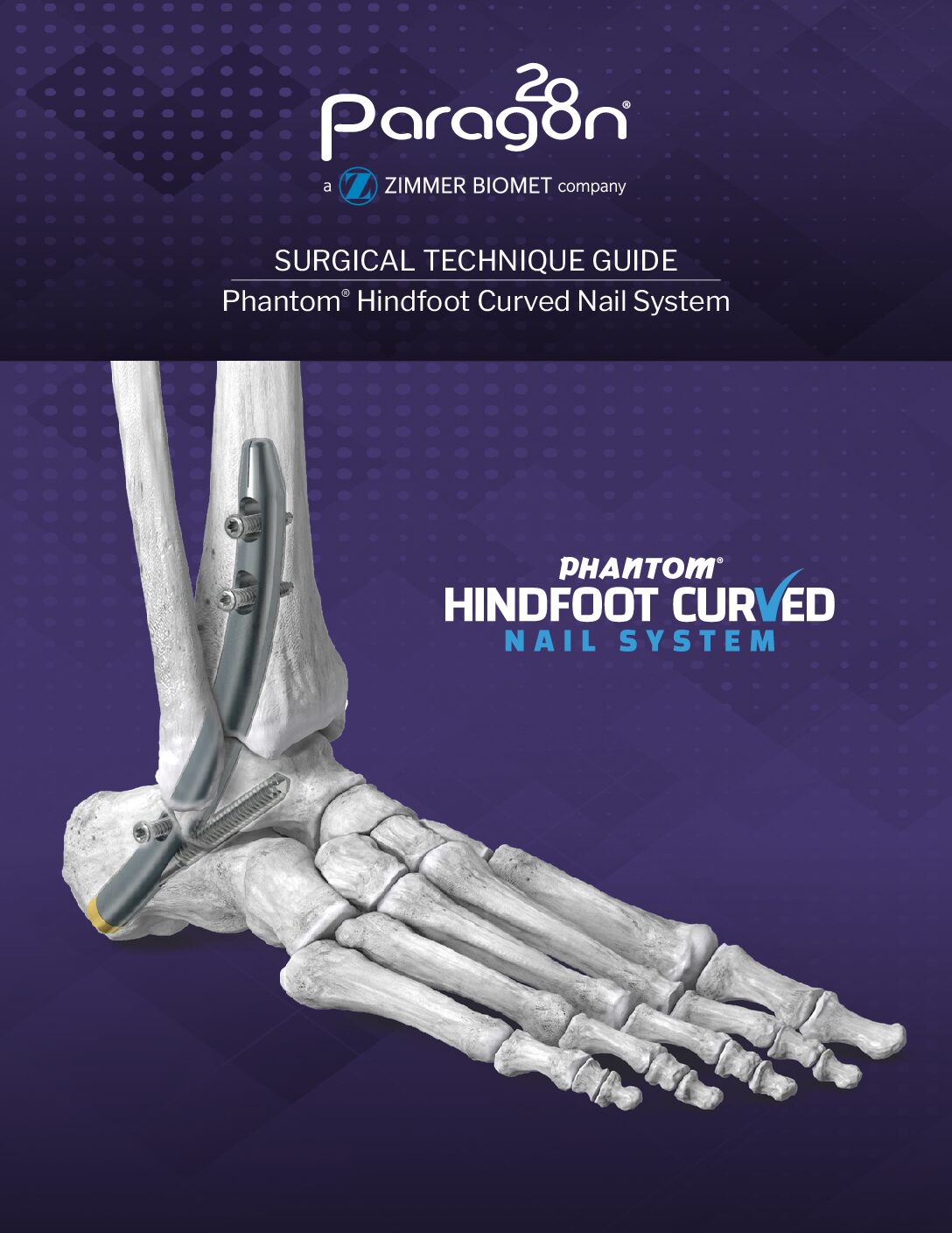 https://paragon28.com/app/uploads/2020/01/P32-STG-0001-RevB_Phantom_Curved_Nail_STG-US-1-pdf.jpg