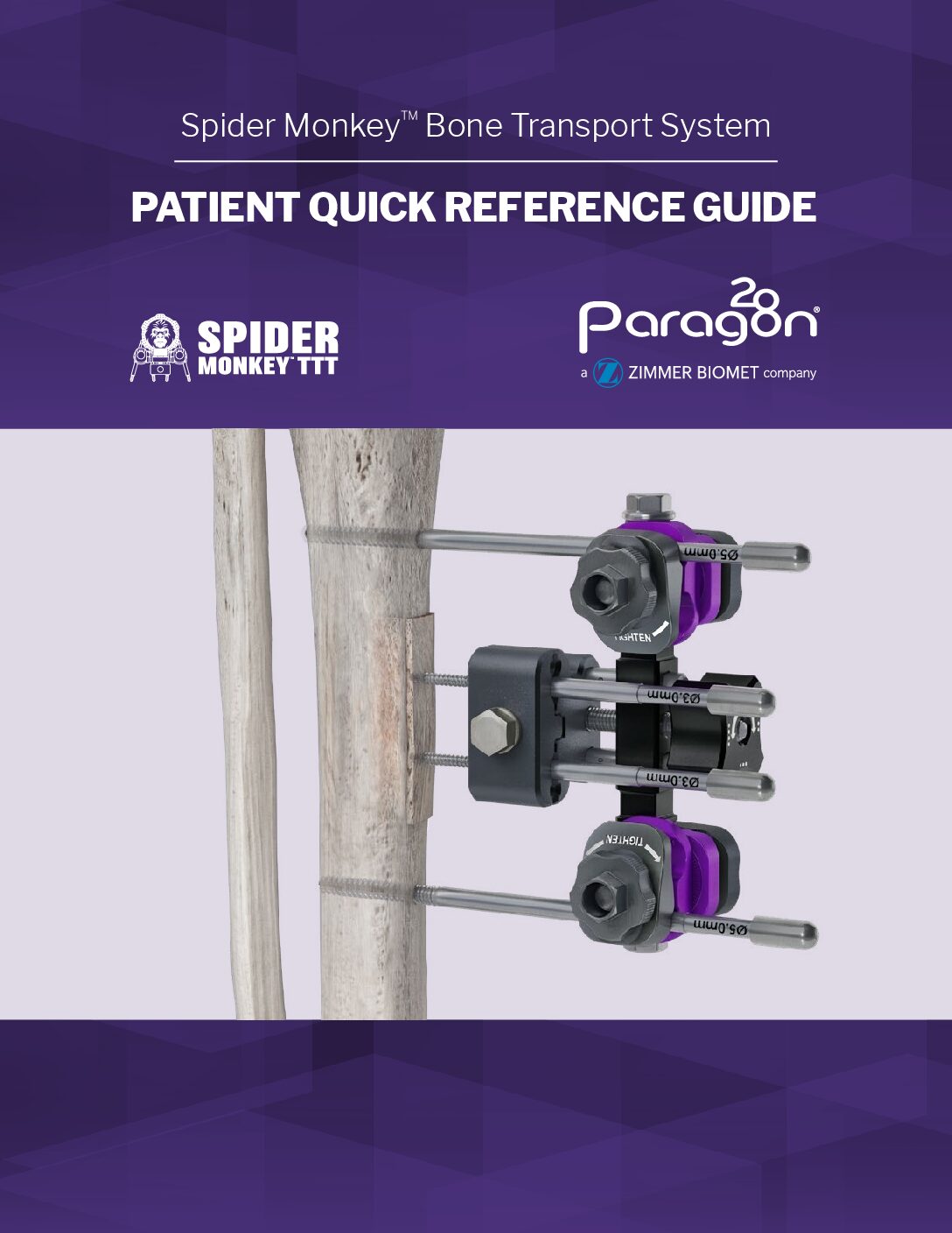 https://paragon28.com/app/uploads/2020/01/P38-QRG-0001-RevA_Patient_Reference_Guide-pdf.jpg