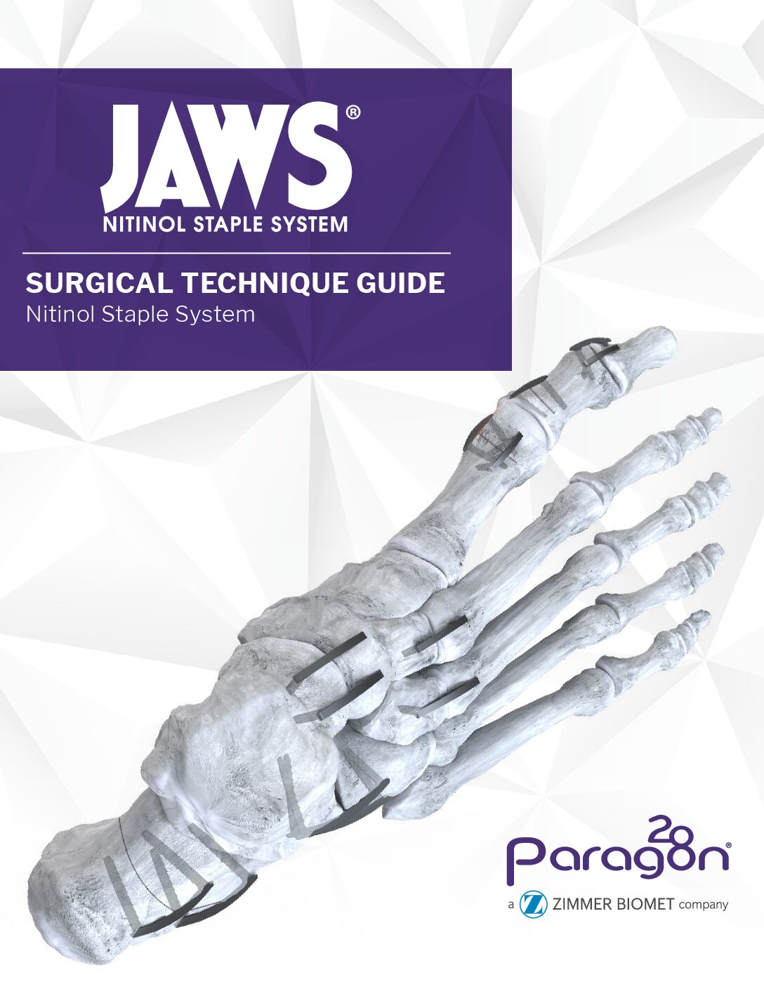 https://paragon28.com/app/uploads/2020/01/P70-STG-3001_RevB_JAWS_NitinolSTG_AUS-pdf.jpg