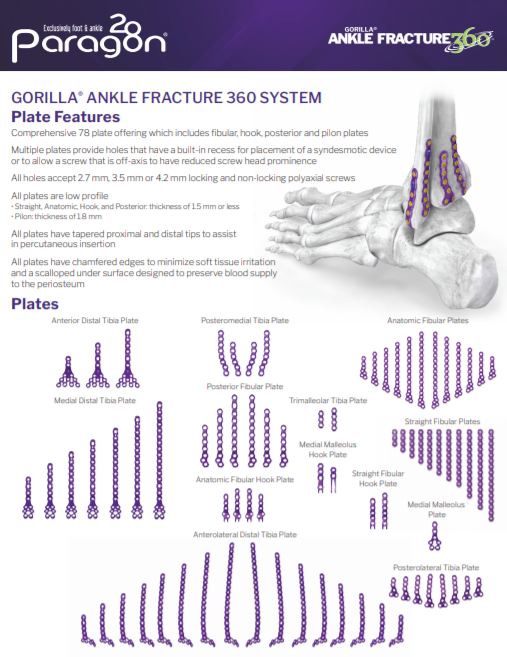 Ankle Fracture 360