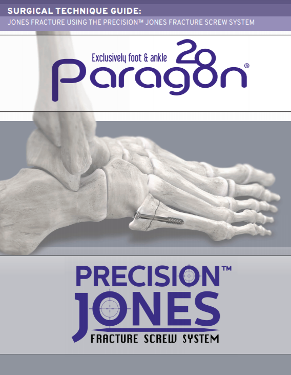 Precision Jones™ Fracture Screw System Surgical Technique Guide (CAN)