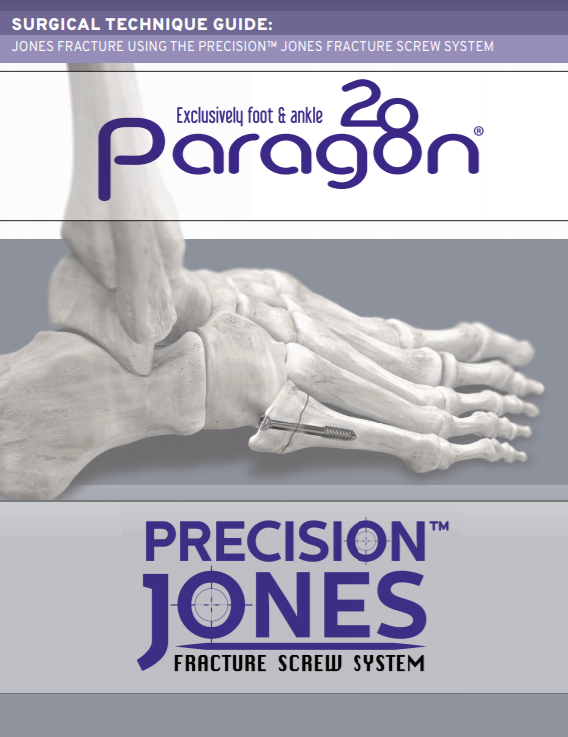 Precision Jones™ Fracture Screw System Surgical Technique Guide (US)