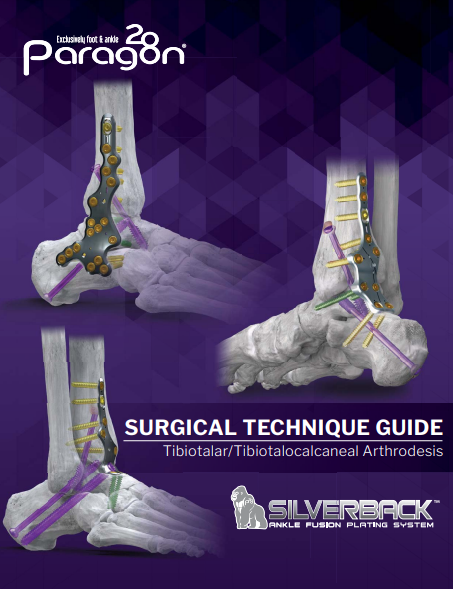 Silverback Ankle Fusion Plating System Surgical Technical Guide