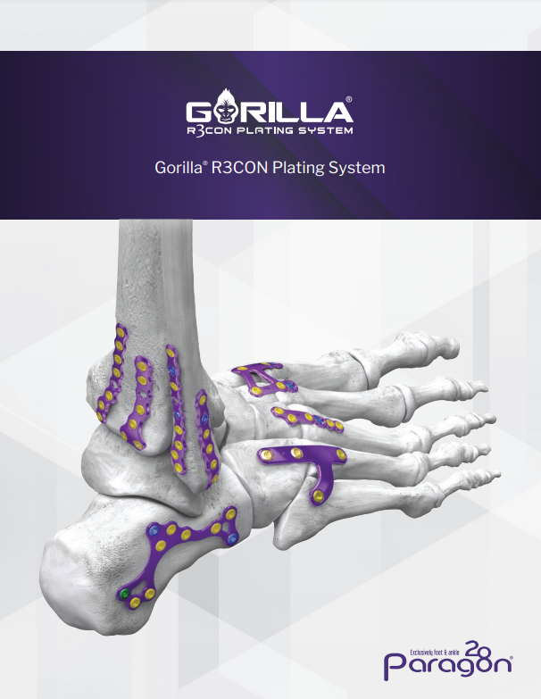 gorilla r3con brochure