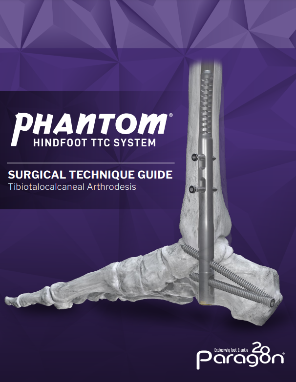 phantom hindfoot stg