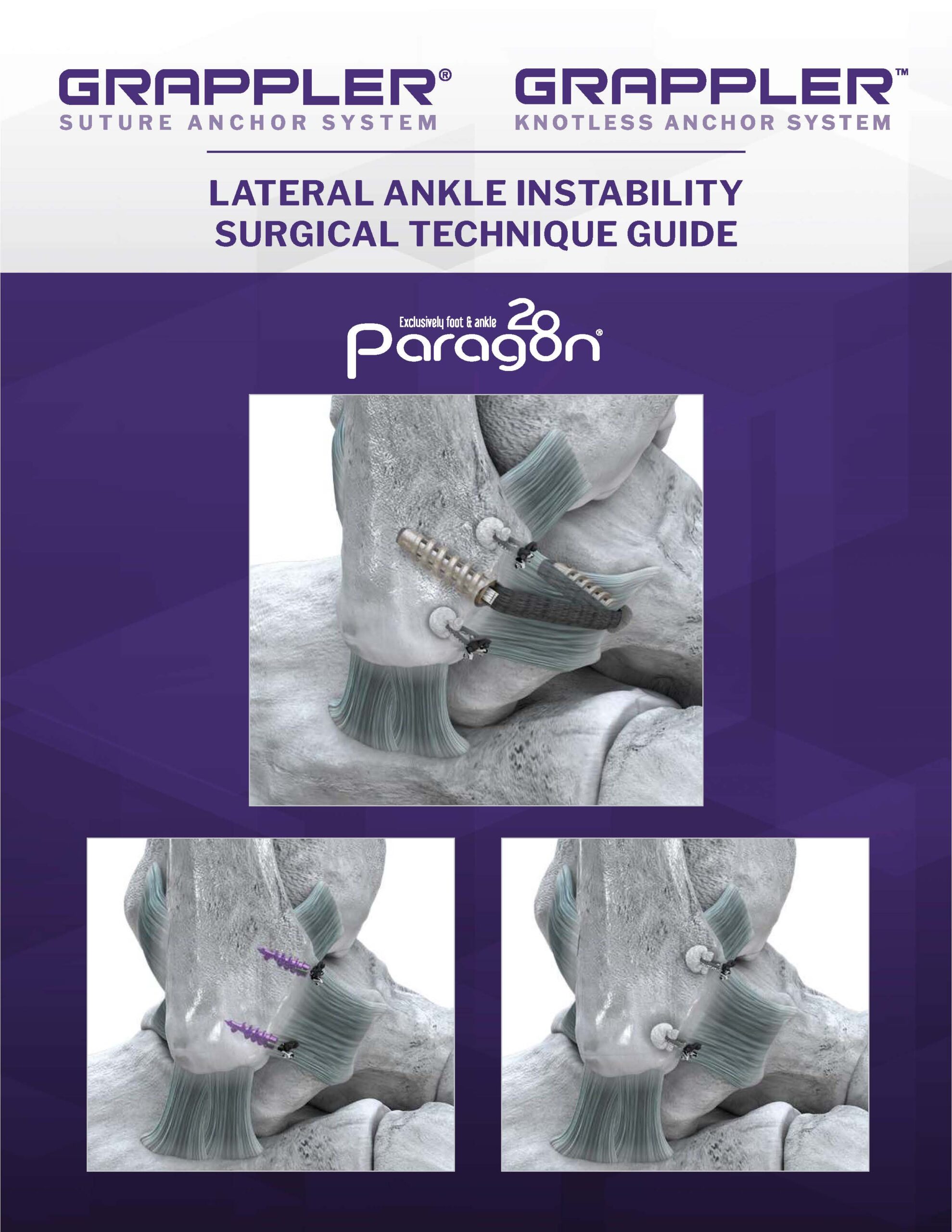 https://paragon28.com/app/uploads/2025/06/P44-STG-0001-GSAS-Brostrom-Technique-STG-RevD_Cover-Image-1-scaled.jpg