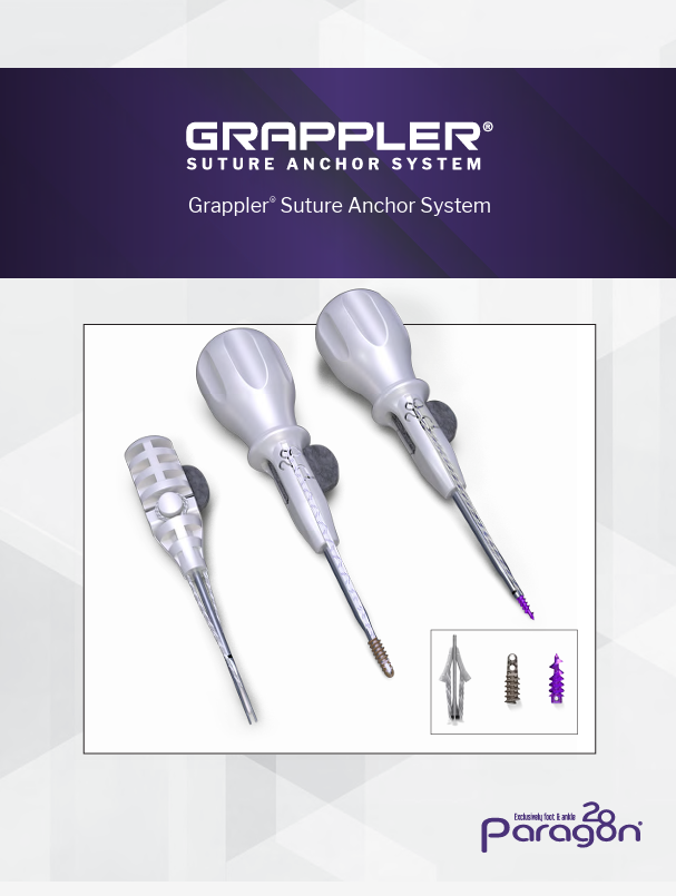 https://paragon28.com/app/uploads/2025/06/Suture-Anchor-Brochure.png