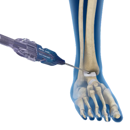 Minimally Invasive