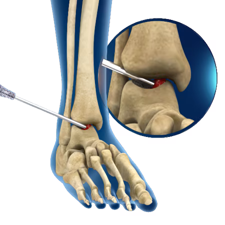 Minimally Invasive