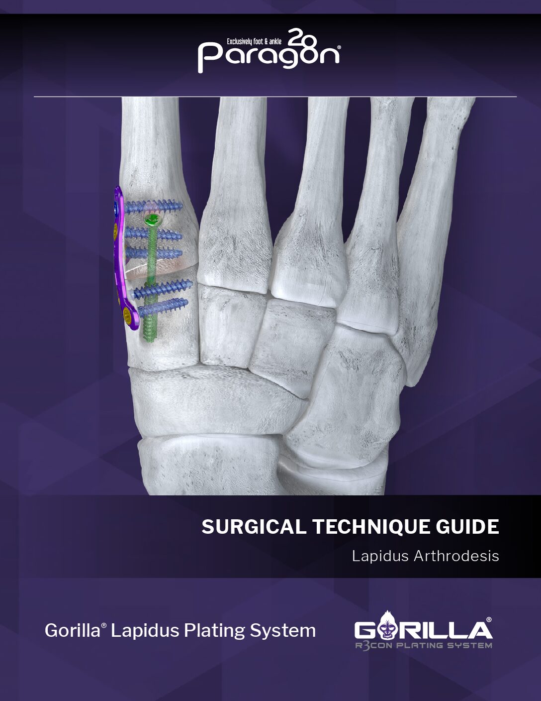 https://paragon28.com/app/uploads/2025/07/P51-STG-0003-RevG_Gorilla_Lapidus_STG_US-pdf-1.jpg