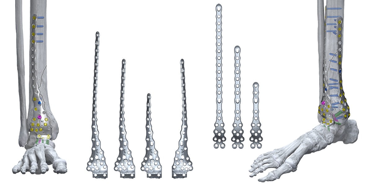 Zimmer Biomet Launches Two New Foot and Ankle Solutions for Complex Trauma Cases