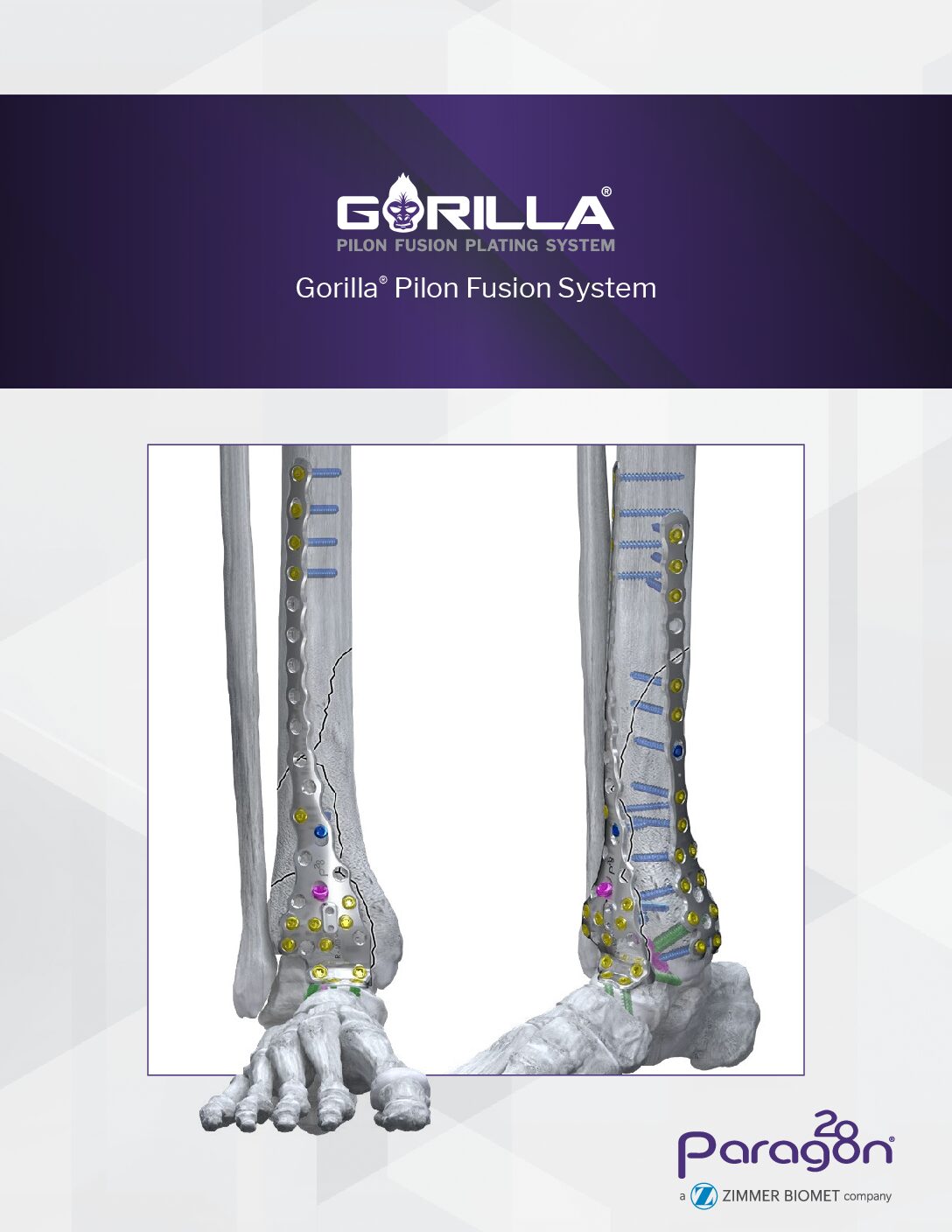 https://paragon28.com/app/uploads/2025/08/GPF-BRO-01-RevA_GorillaPilon_Brochure418911614797-pdf.jpg