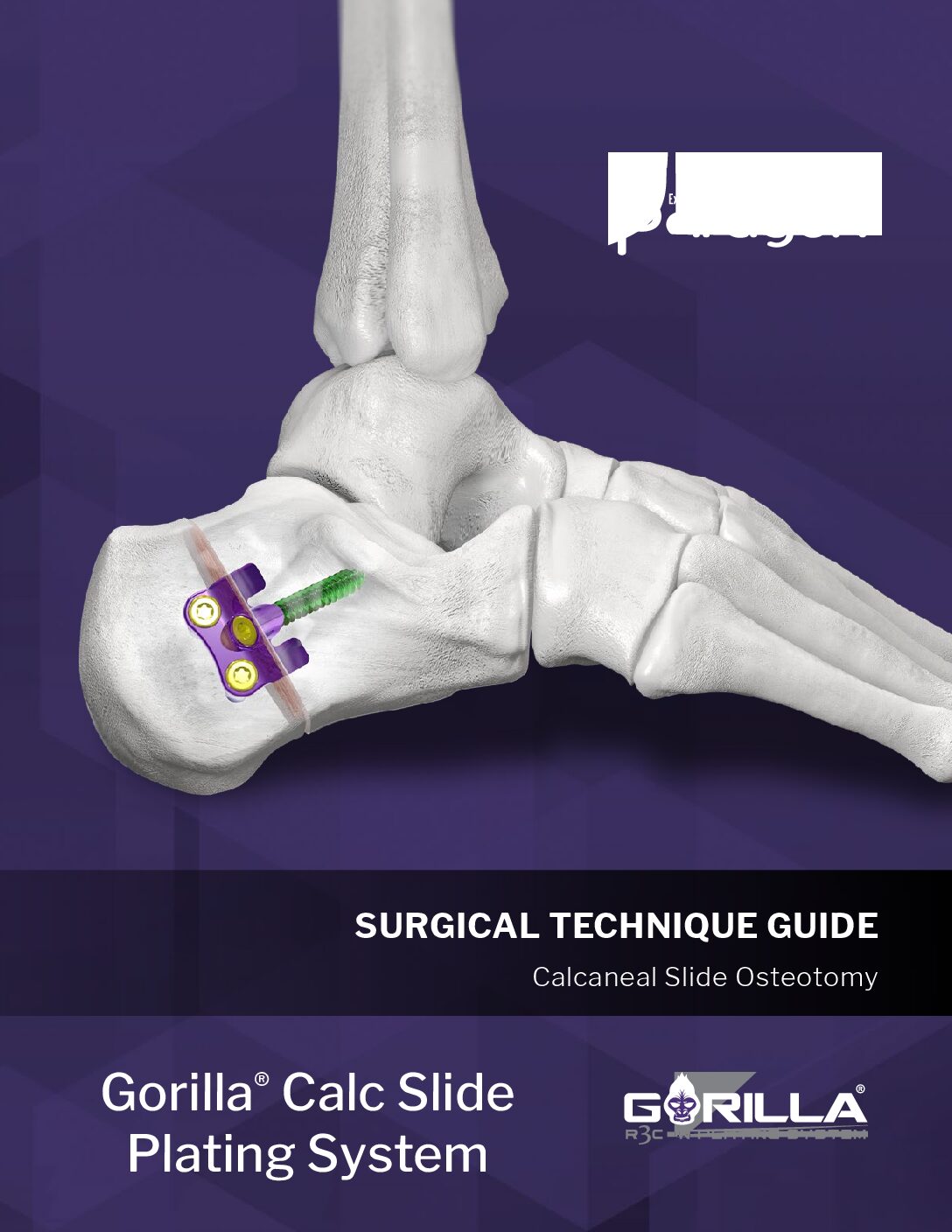 https://paragon28.com/app/uploads/2025/08/P51-STG-0004-RevF_Gorilla-Calc-Slide-Plate-STG-US-pdf.jpg