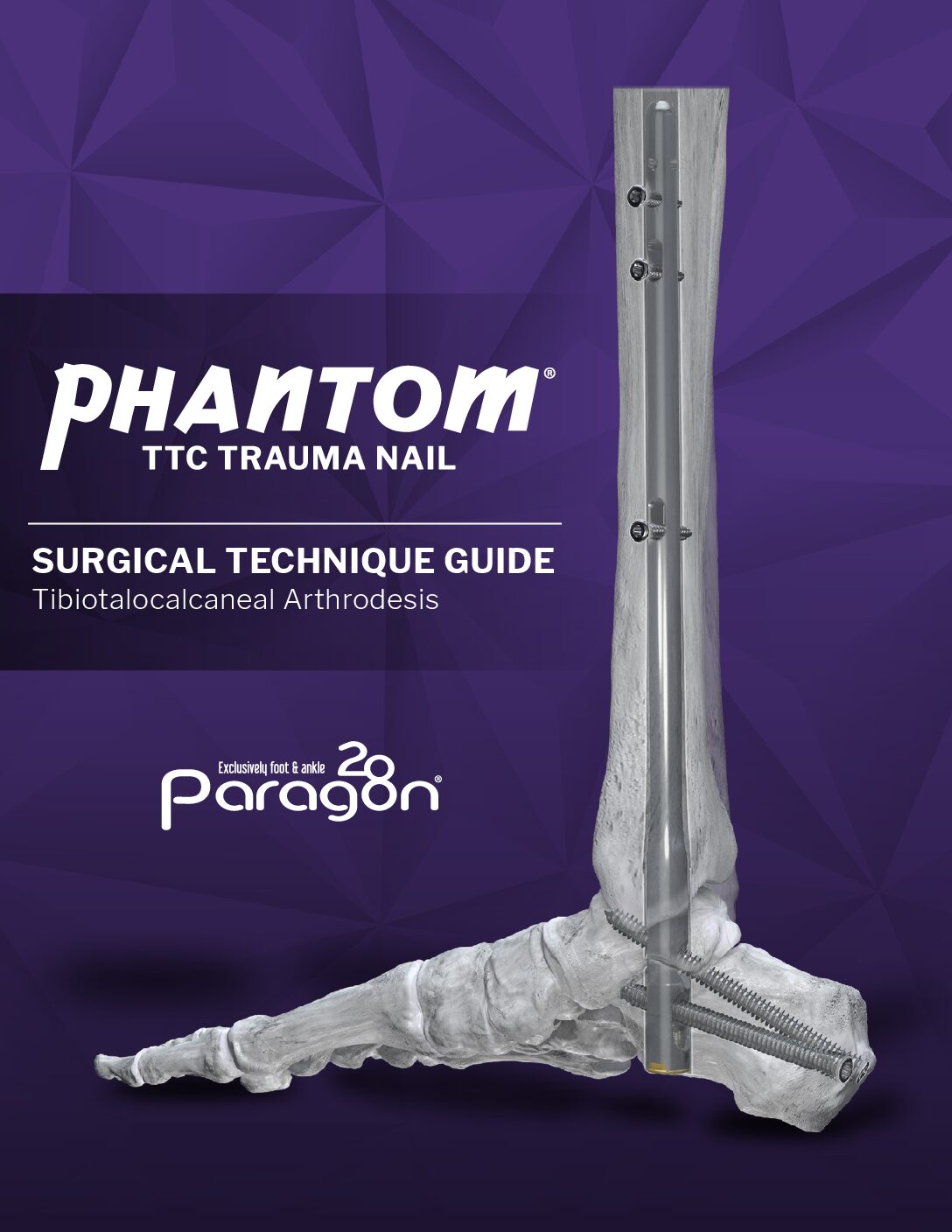 https://paragon28.com/app/uploads/2025/09/P31-STG-0004-TTC-Trauma-Nail-STG-RevA-US-pdf.jpg