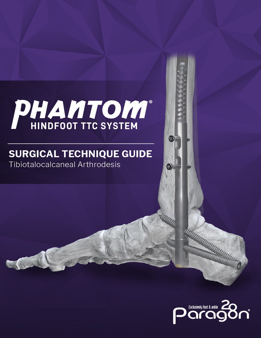 https://paragon28.com/app/uploads/2025/09/P31-STG-1001-RevF_PhantomTTCNail_STG_OUS-pdf.jpg