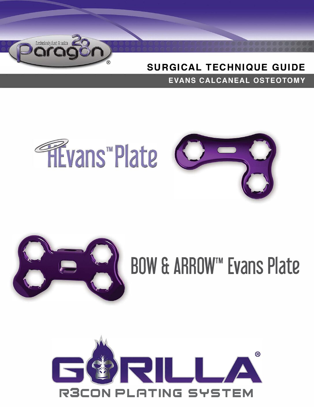 https://paragon28.com/app/uploads/2025/09/P51-STG-0005-RevD_Gorilla-Evans-Procedure-STG-US-pdf.jpg