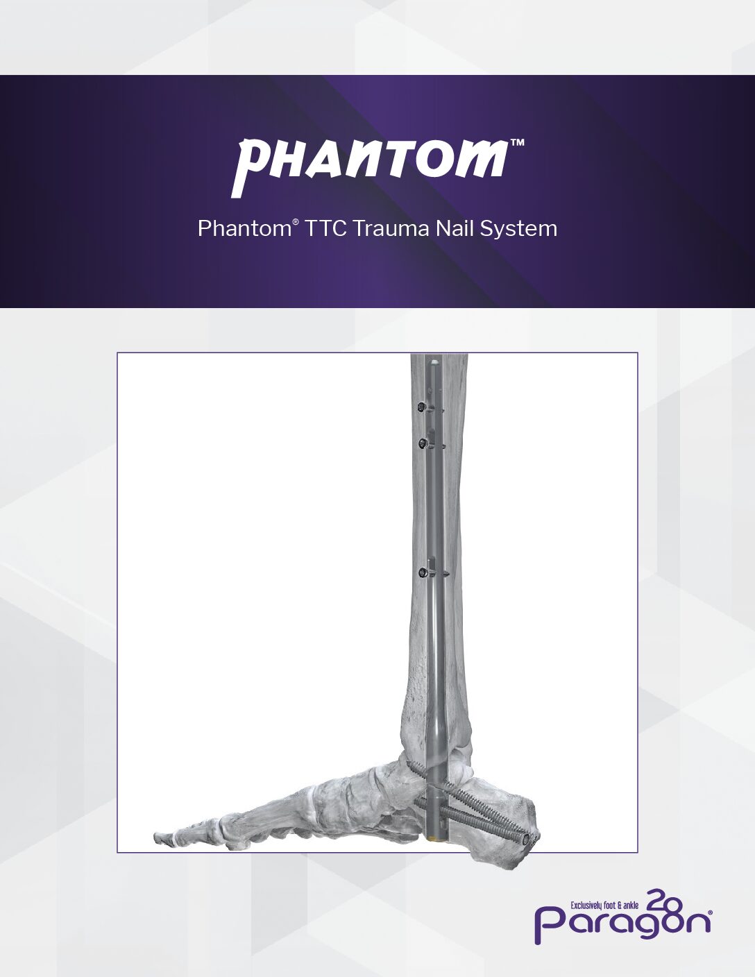 https://paragon28.com/app/uploads/2025/09/PhantomTraumaNailBrochure-pdf.jpg