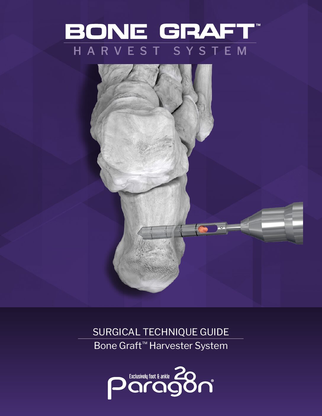 https://paragon28.com/app/uploads/2025/11/P99-STG-0002-RevA-Bone-Graft-Harvester-STG-US-pdf.jpg