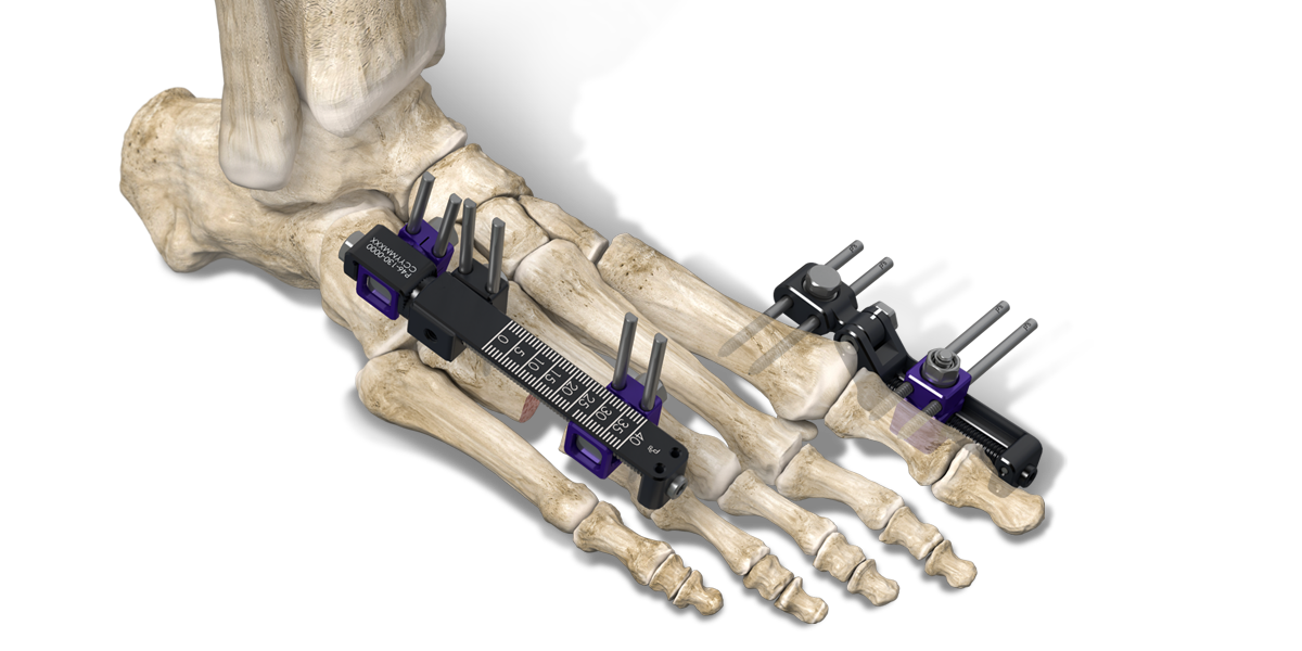 Website_HeroShot_Brachiator