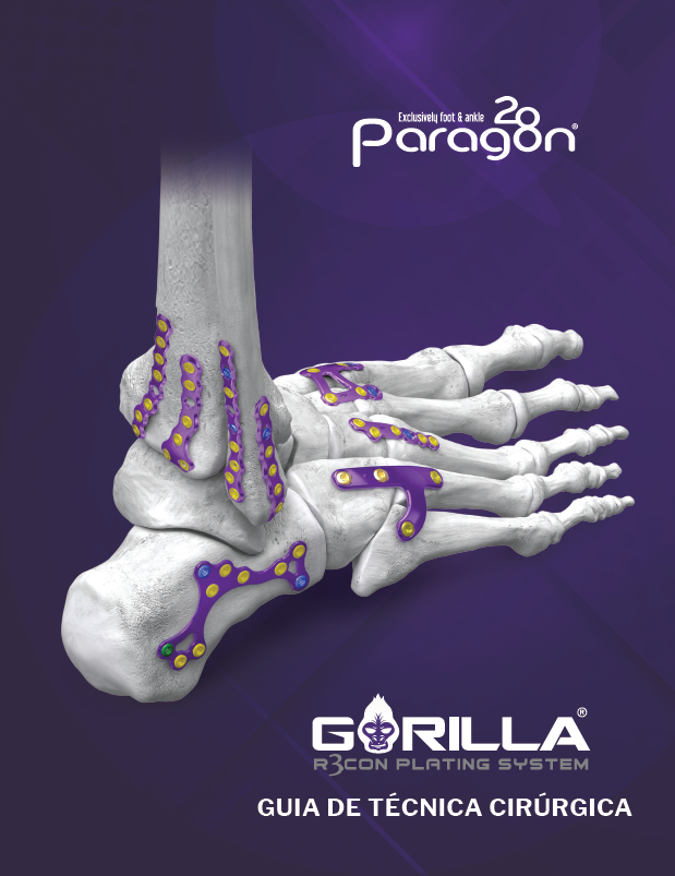 https://paragon28.com/app/uploads/2026/01/Gorilla-Plating-System-STG-BZL_Image.png