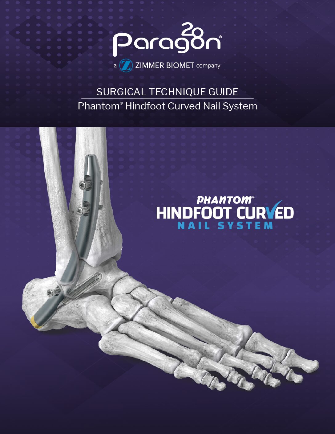 https://paragon28.com/app/uploads/2026/01/P32-STG-0001-RevA_Phantom_Curved_Nail_STG-US-pdf.jpg