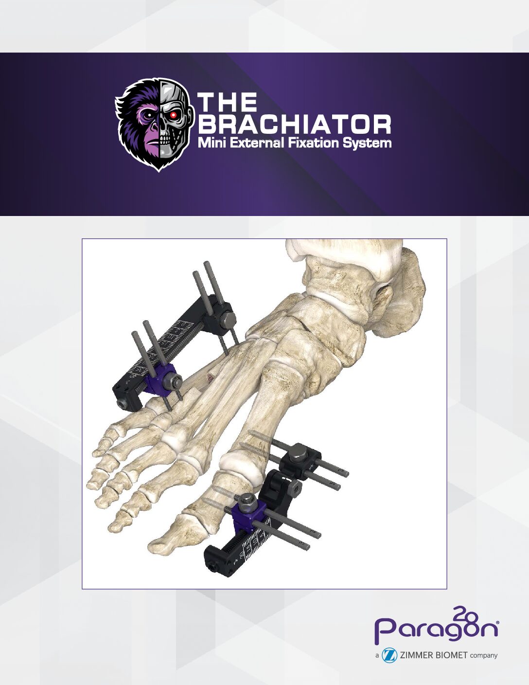https://paragon28.com/app/uploads/2026/02/C32952-Brachiator-Launch-Materials-DIGITAL-pdf.jpg