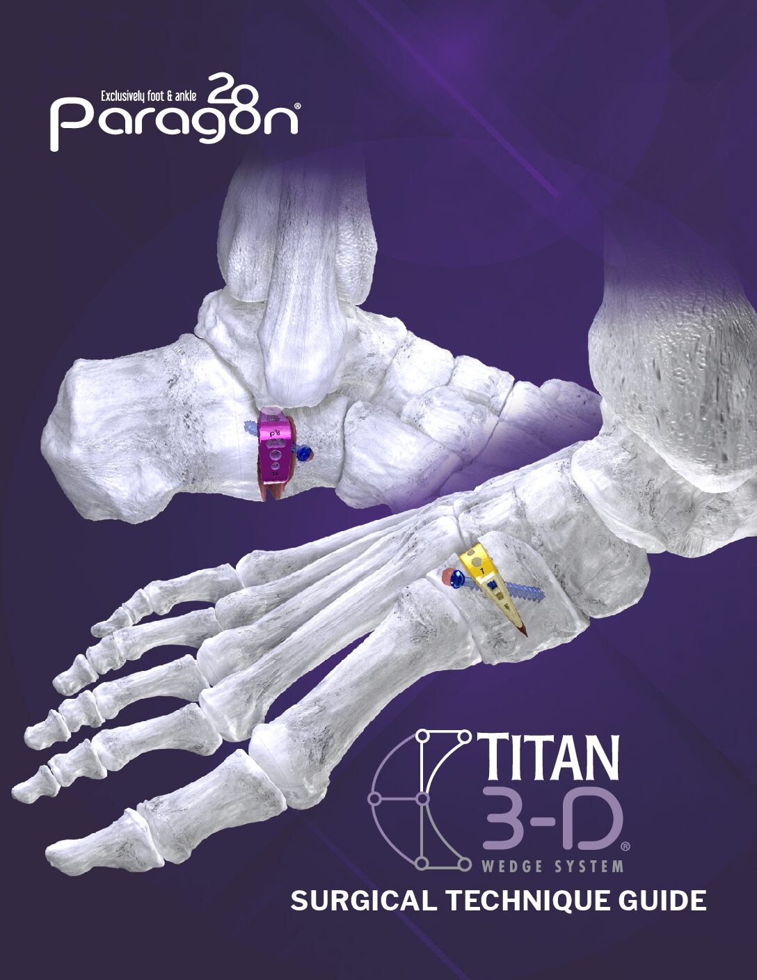 https://paragon28.com/app/uploads/2026/02/P03-STG-1001_RevF_TITAN3DWedgeSystem_STG_CEMarked-pdf.jpg