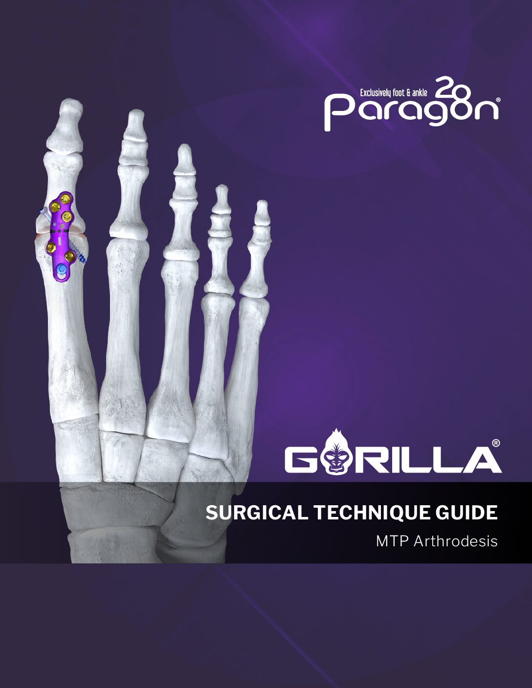 https://paragon28.com/app/uploads/2026/02/P51-STG-0002-Rev-H_Gorilla-MTP-Plating-System-STG-US-pdf.jpg