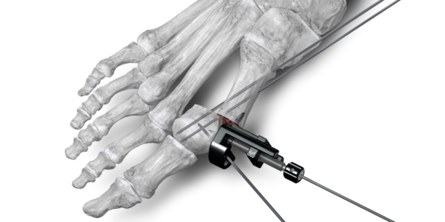 Website_Hero_Shot_Precision_Pusher_ext