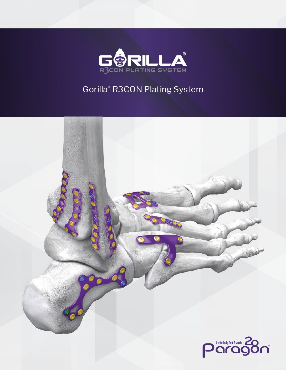 https://paragon28.com/app/uploads/2026/03/GOBR-01-RevJ-Gorilla-R3CON-Plating-System-Brochure_Final-pdf.jpg