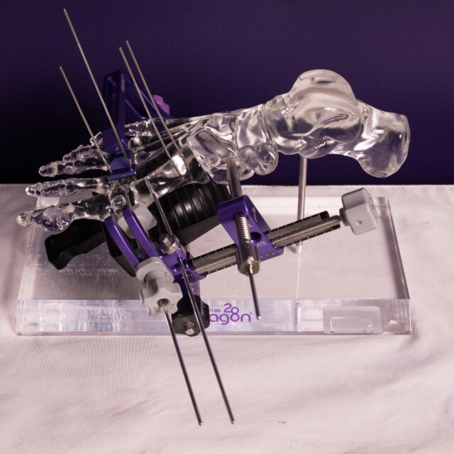 ABYM-1
