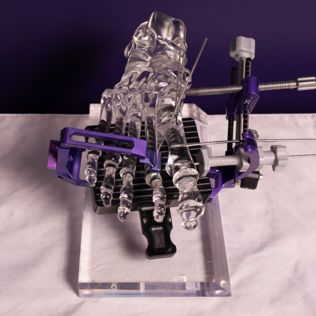 ABYM-2