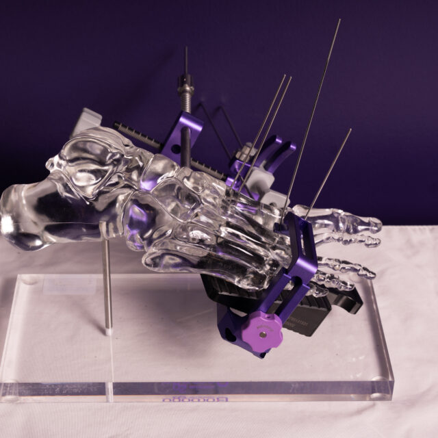 ABYM-3