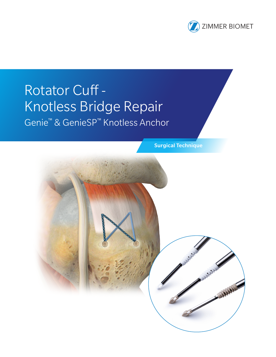 https://paragon28.com/app/uploads/2026/07/thumb-genie-rc-knotless-bridge-repair.png