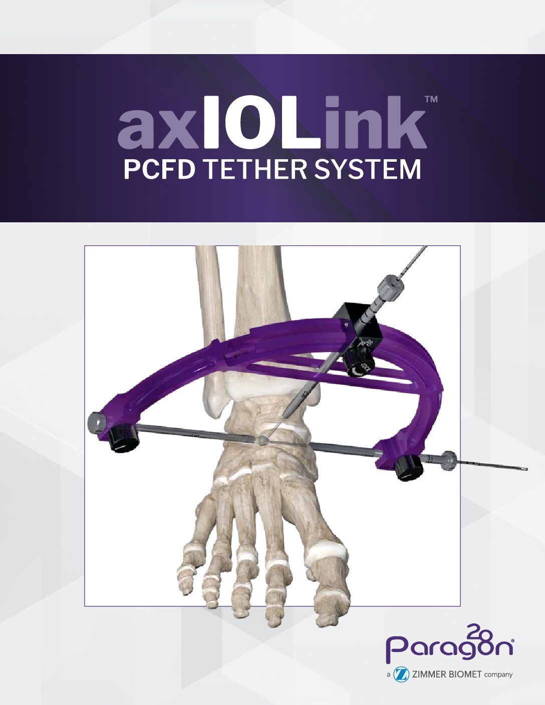 https://paragon28.com/app/uploads/2026/08/IOL-BRO-01-REV-A-AxioLink-Brochure-V2-003_FInal-pdf.jpg