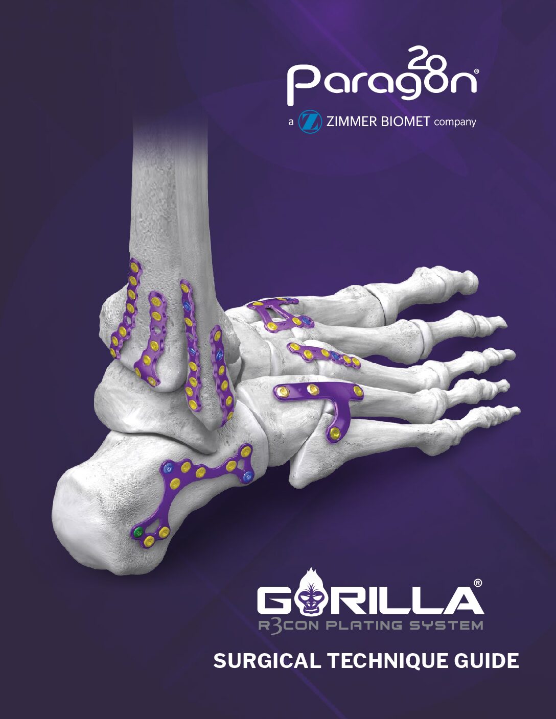https://paragon28.com/app/uploads/2026/08/P51-STG-3001-RevD_Gorilla-Plating-System_STG_AUS-pdf.jpg