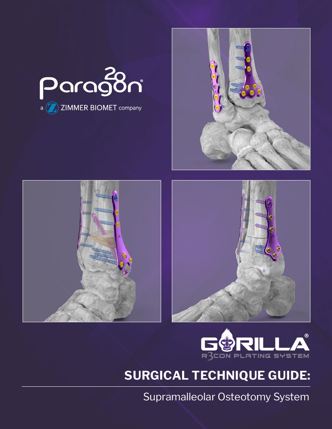 https://paragon28.com/app/uploads/2026/08/P51-STG-3014-RevB_Gorilla-SMO-Plating-System_STG_AUS-pdf.jpg