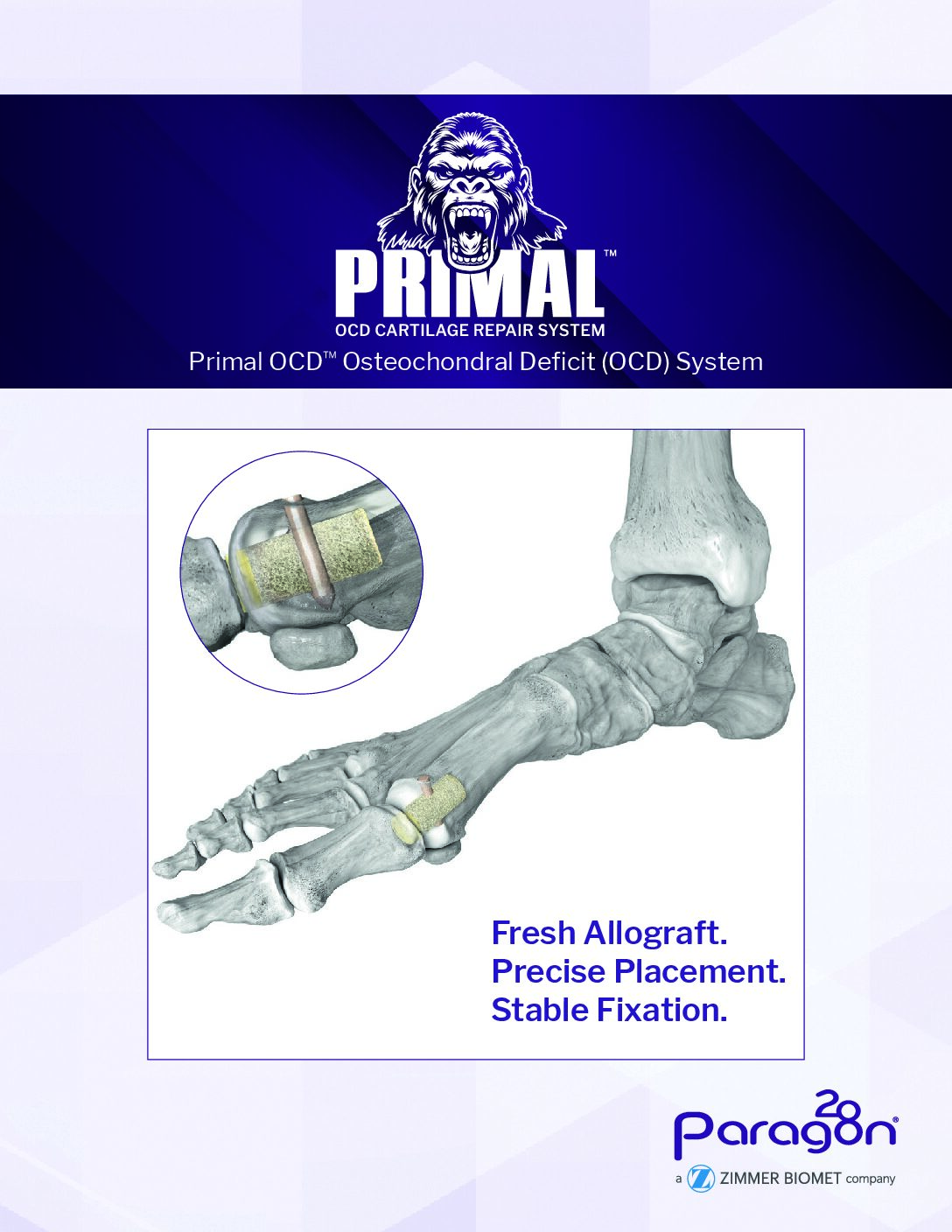 https://paragon28.com/app/uploads/2026/09/BRO-PROCD-01-REV-A-Primal-OCD-Brochure-V2_FINAL-1-pdf.jpg