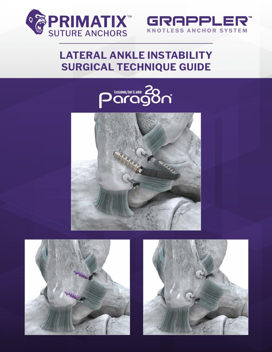 https://paragon28.com/app/uploads/2026/09/P44-STG-0003-GSAS-PRIMATIX-Technique-STG-RevA-US-pdf.jpg