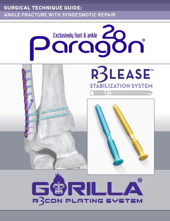 R3LEASE™ Stabilization System Surgical Technique Guide (CAN)