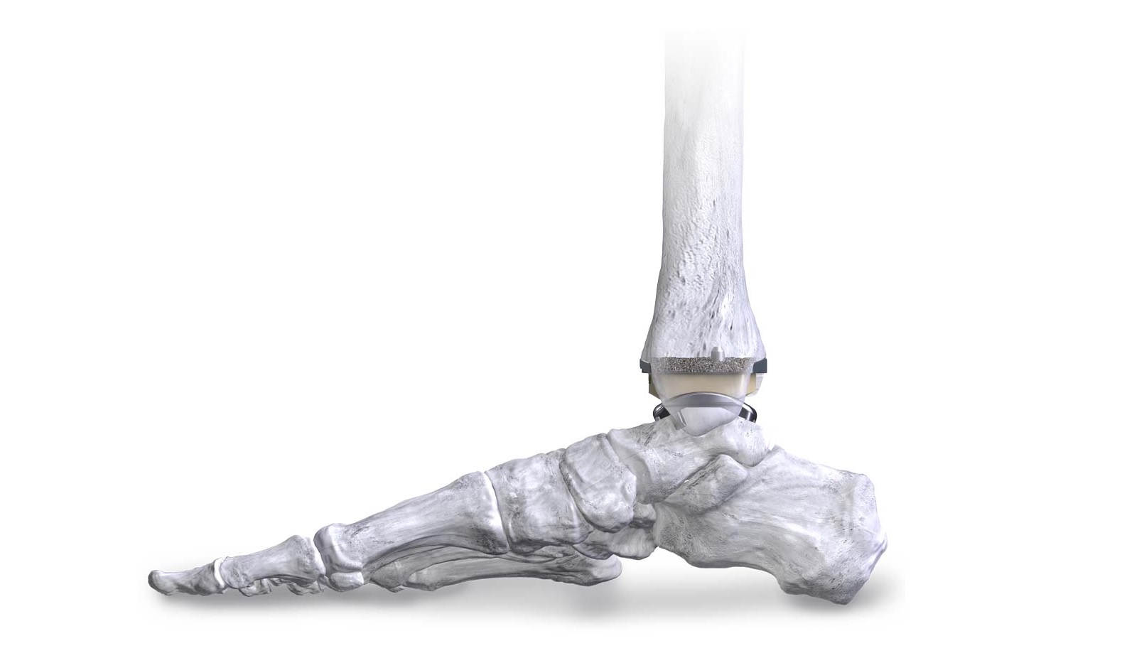 APEX 3D