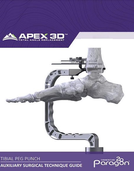 https://paragon28.com/wp-content/uploads/2022/01/APEX-3D™-Tibial-Peg-Punch-Auxiliary-Surgical-Technique-Guide-1.jpg