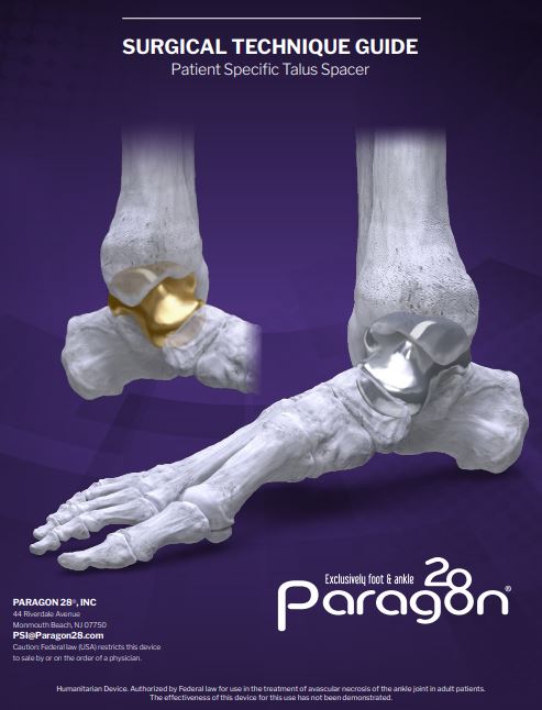 https://paragon28.com/wp-content/uploads/2022/03/STG-TTS.jpg