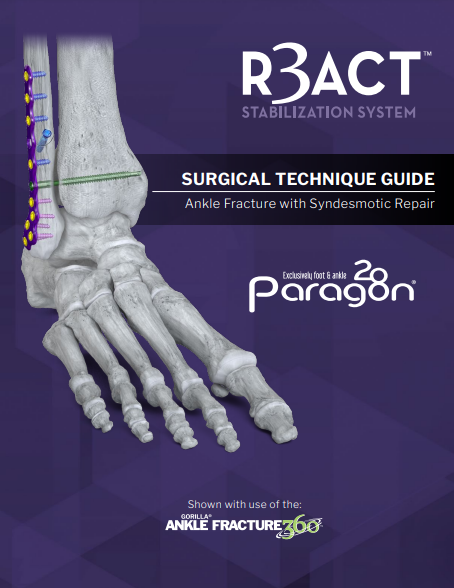 r3act