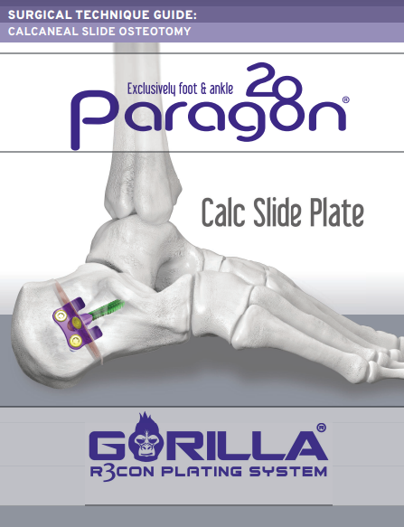 calc slide plate