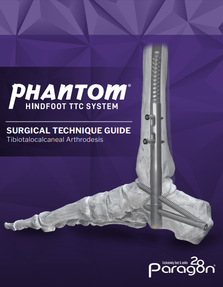 phantom ttc aus